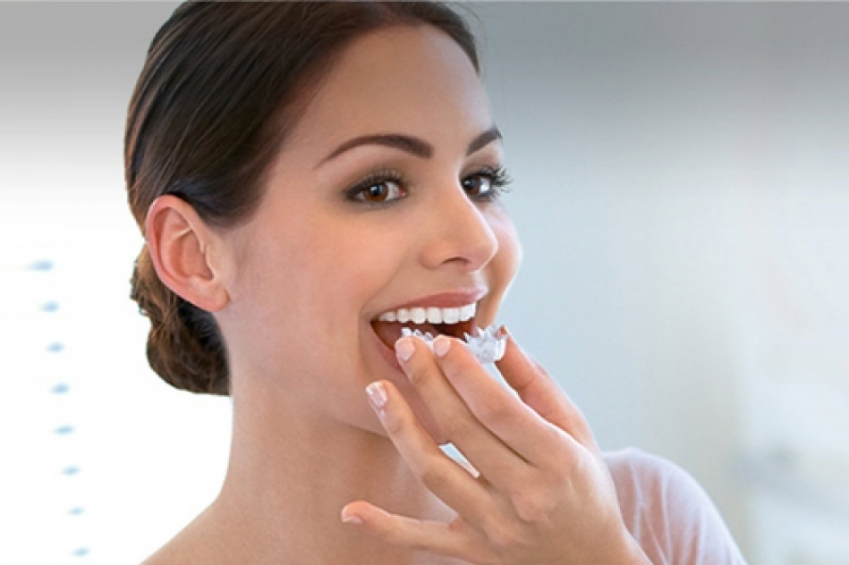 At-home teeth whitening provided by our dentist Mercédesz Hliva