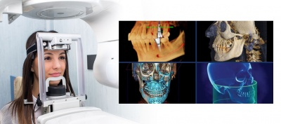 Prémium fogászati CT (CBCT)